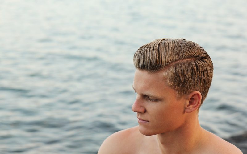 Alles wat je moet weten over een haartransplantatie
